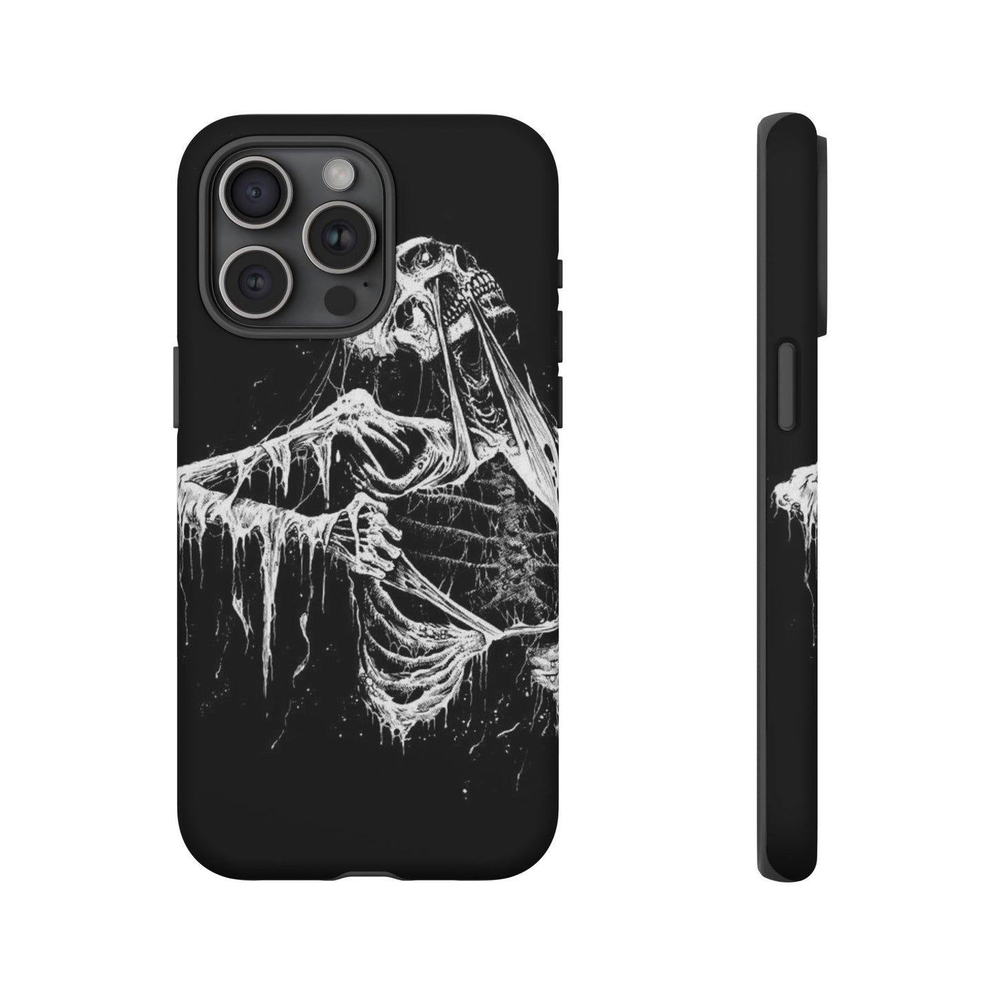 Skeletal iPhone Case