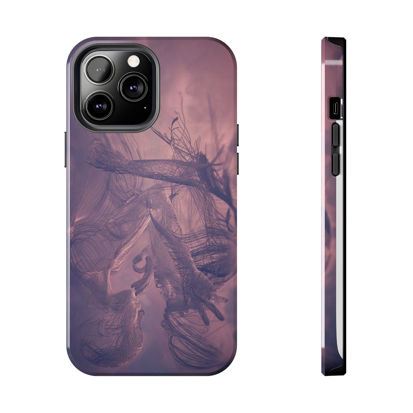 Nerve Skeletal iPhone Case