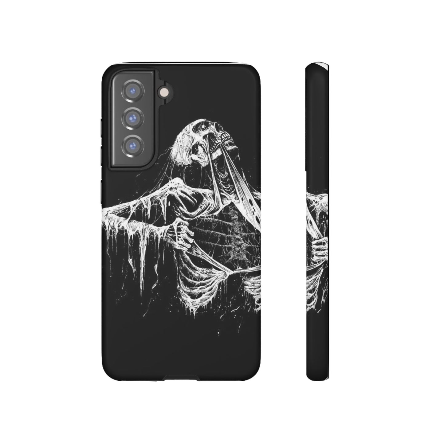 Skeletal iPhone Case