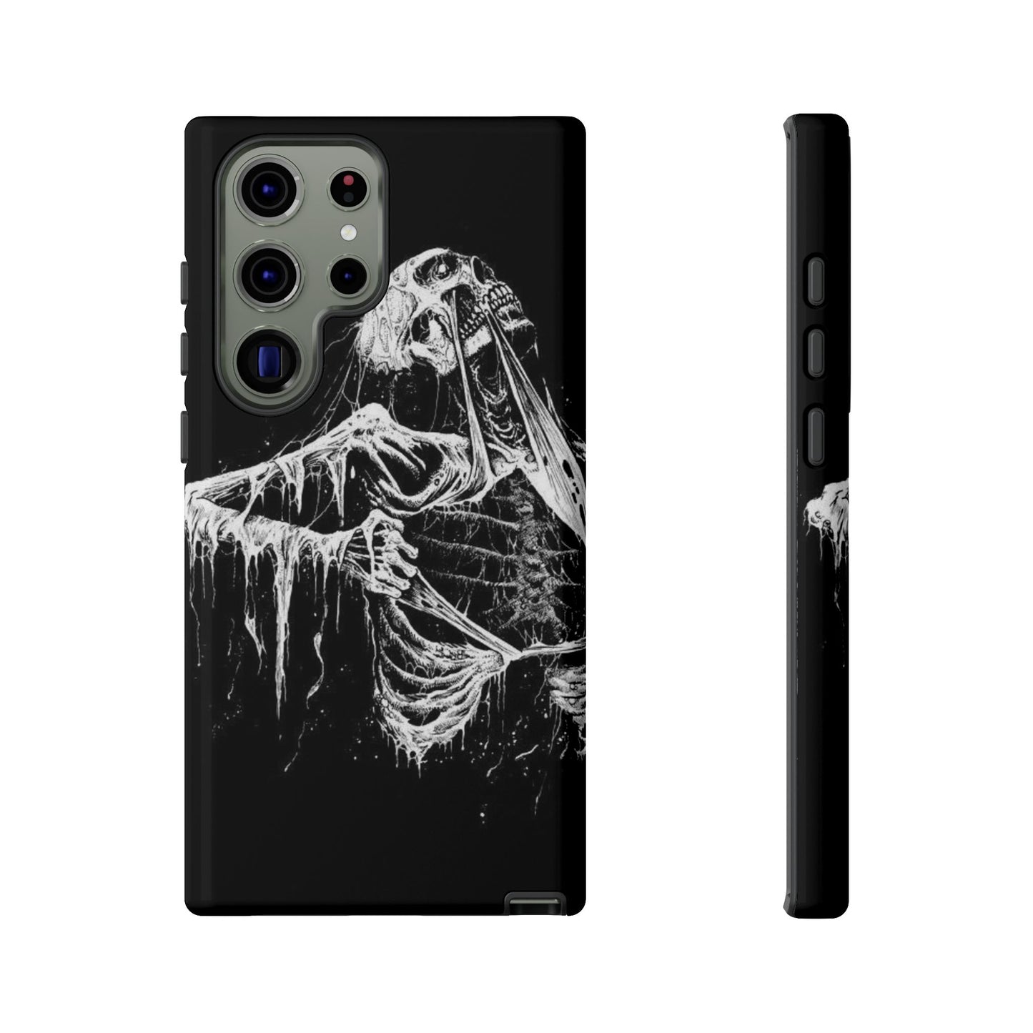 Skeletal iPhone Case