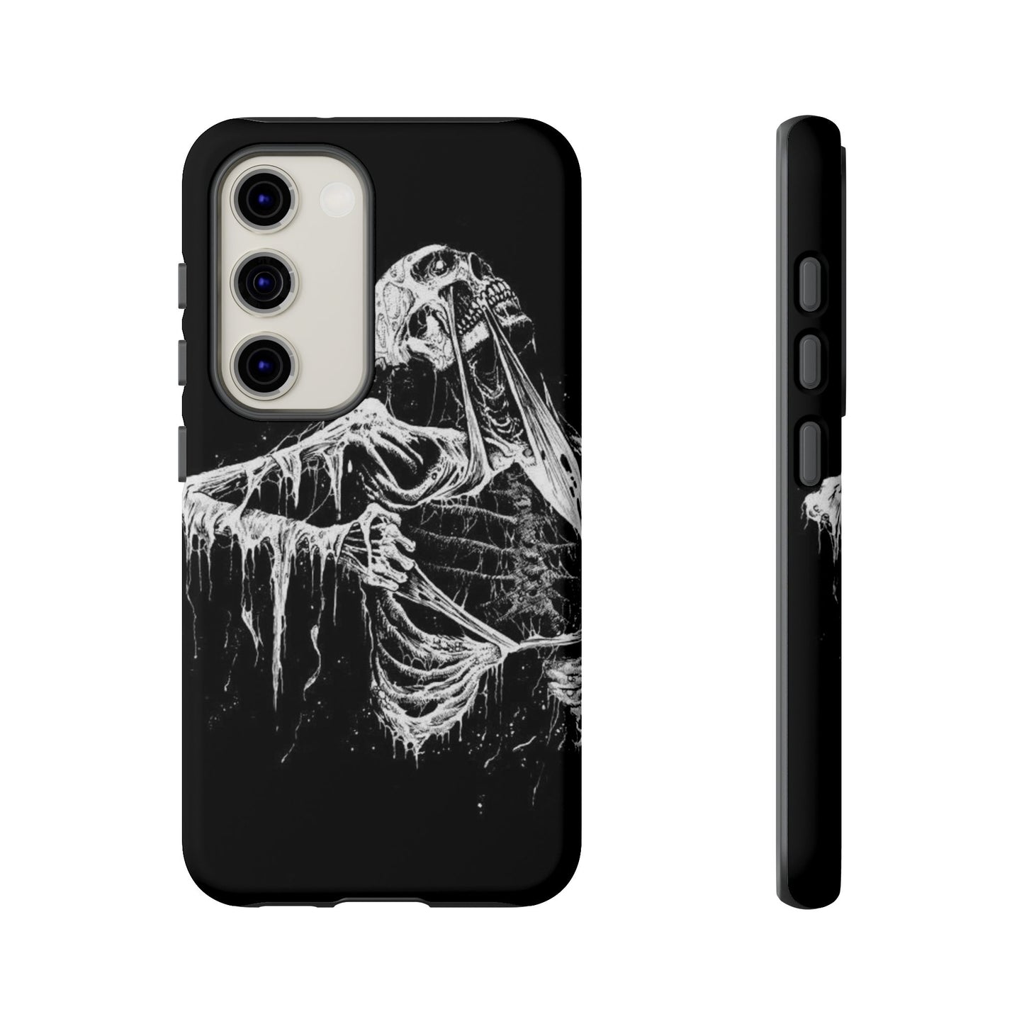 Skeletal iPhone Case