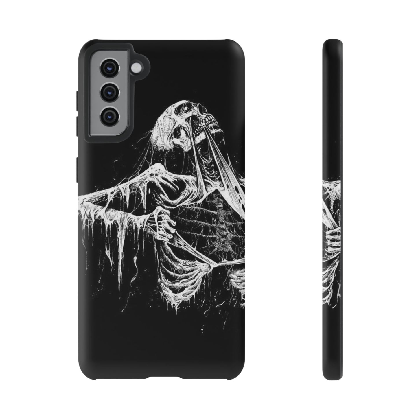 Skeletal iPhone Case