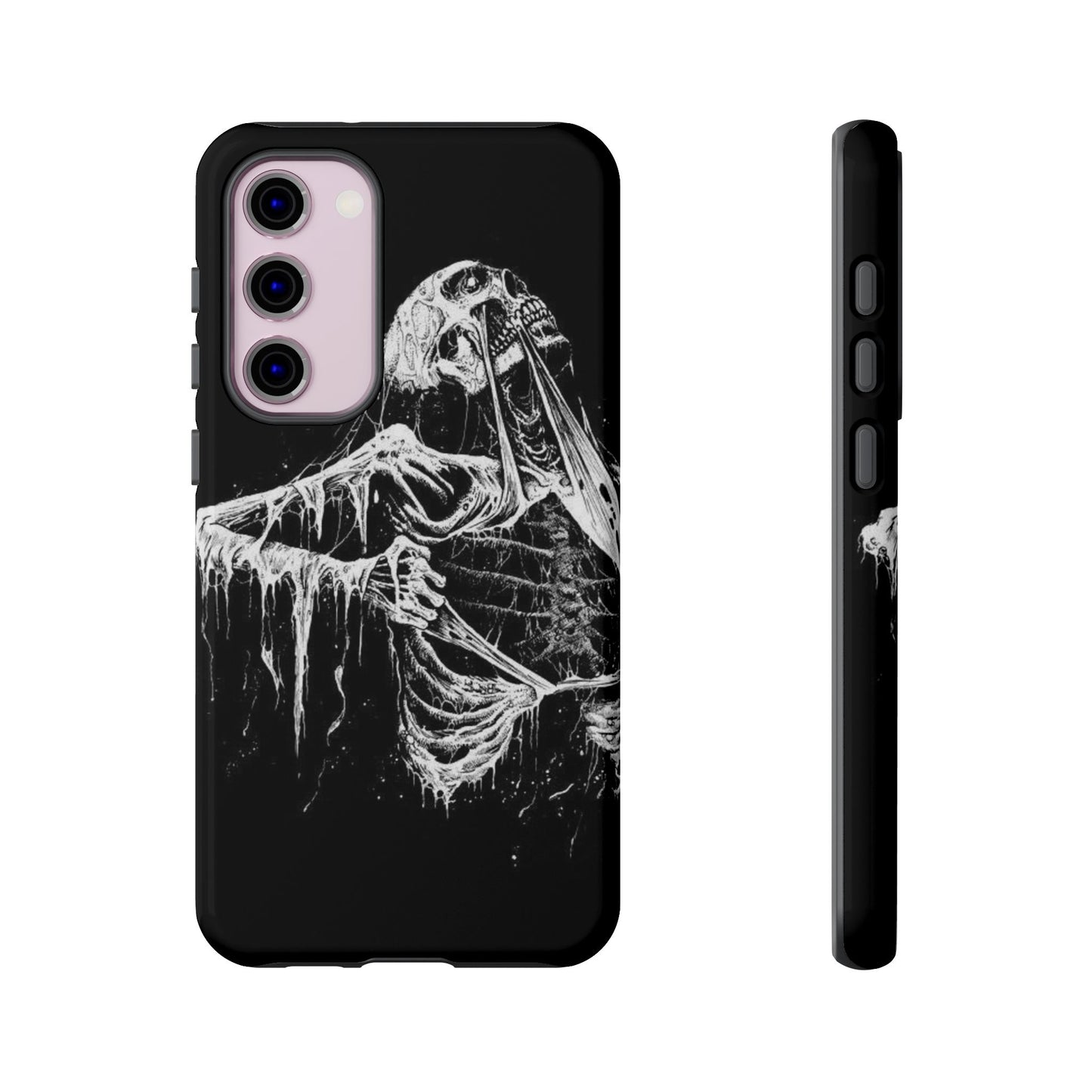 Skeletal iPhone Case