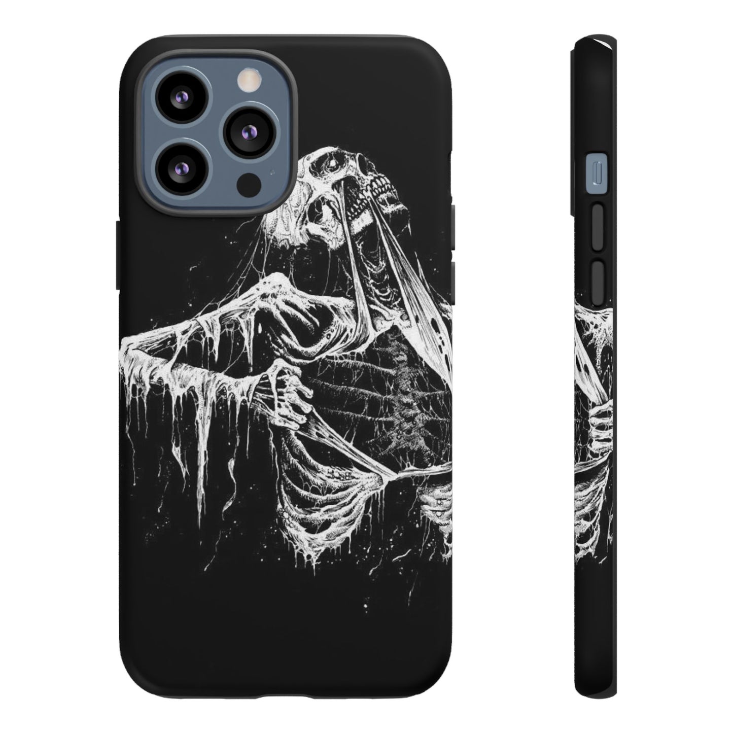 Skeletal iPhone Case