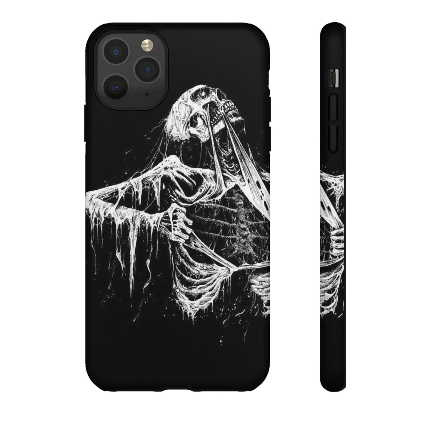 Skeletal iPhone Case